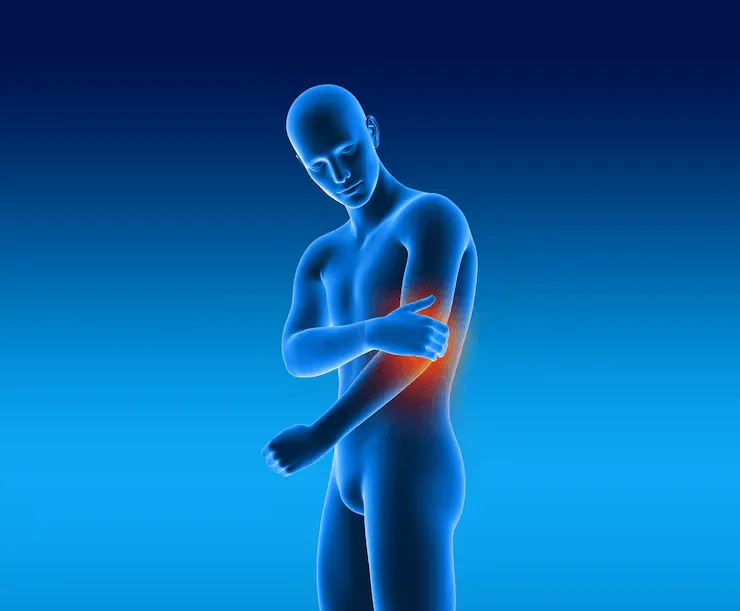 Dolor articular en el codo y el brazo, otra zona donde se usa MegaSteel